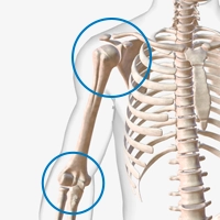 Shoulder and elbow replacement